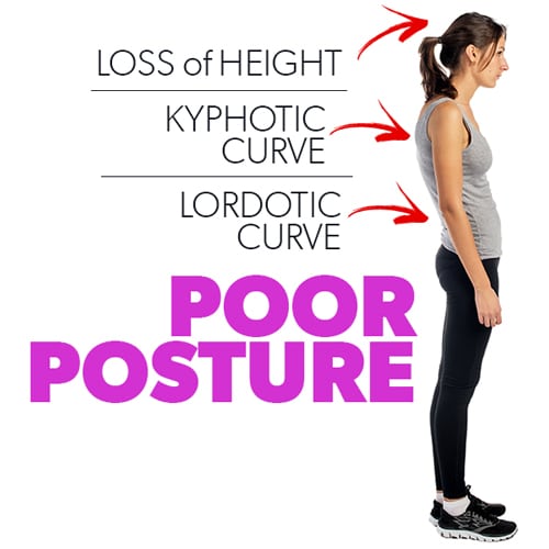 poor-posture