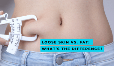 close up of woman stomach pinching fat- loose skin vs fat test