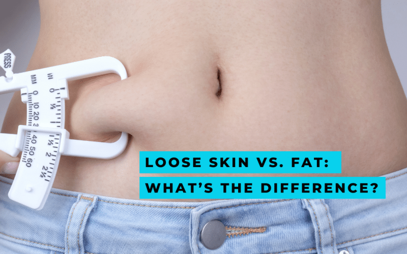 close up of woman stomach pinching fat- loose skin vs fat test